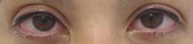 Asian-eyeliner-after
