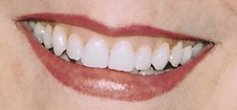 client after permanent lip color micropigmentation