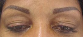 Brows After