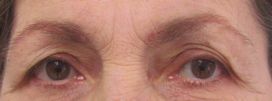 Brows-eyeliner-before
