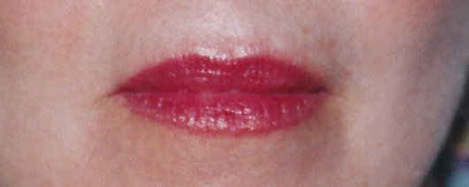 client after permanent lip color correction