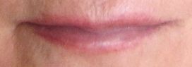 Lips Before