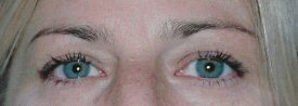 Before Permanent Eyebrows-Eyeliner