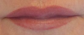 Lips-corrected-healed